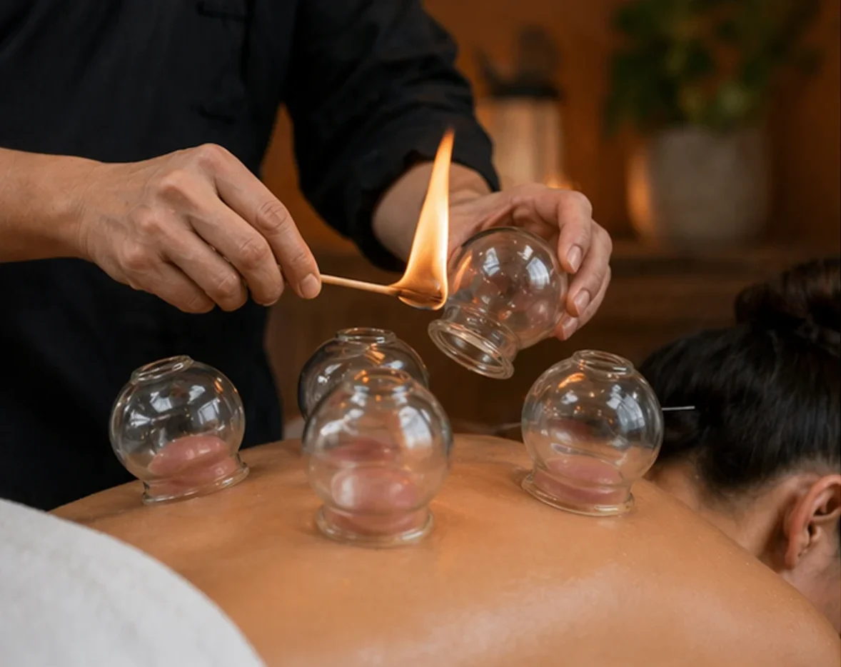 Fire cupping therapy session at Cedar & Sage in Scottsdale and Mesa, AZ