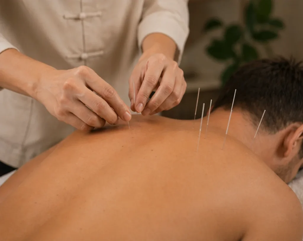 acupuncture-back-treatment-phoenix-az.webp