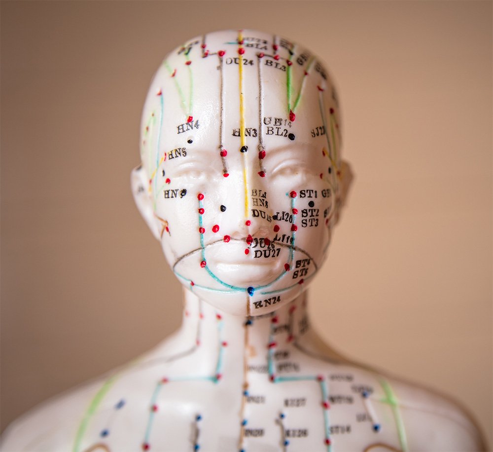Acupuncture Mesa AZ